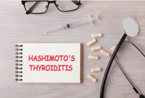 Tiroiditis de Hashimoto, Síntomas